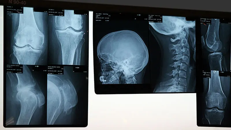 Salles de radiographie, d'échographie et de fluoroscopie